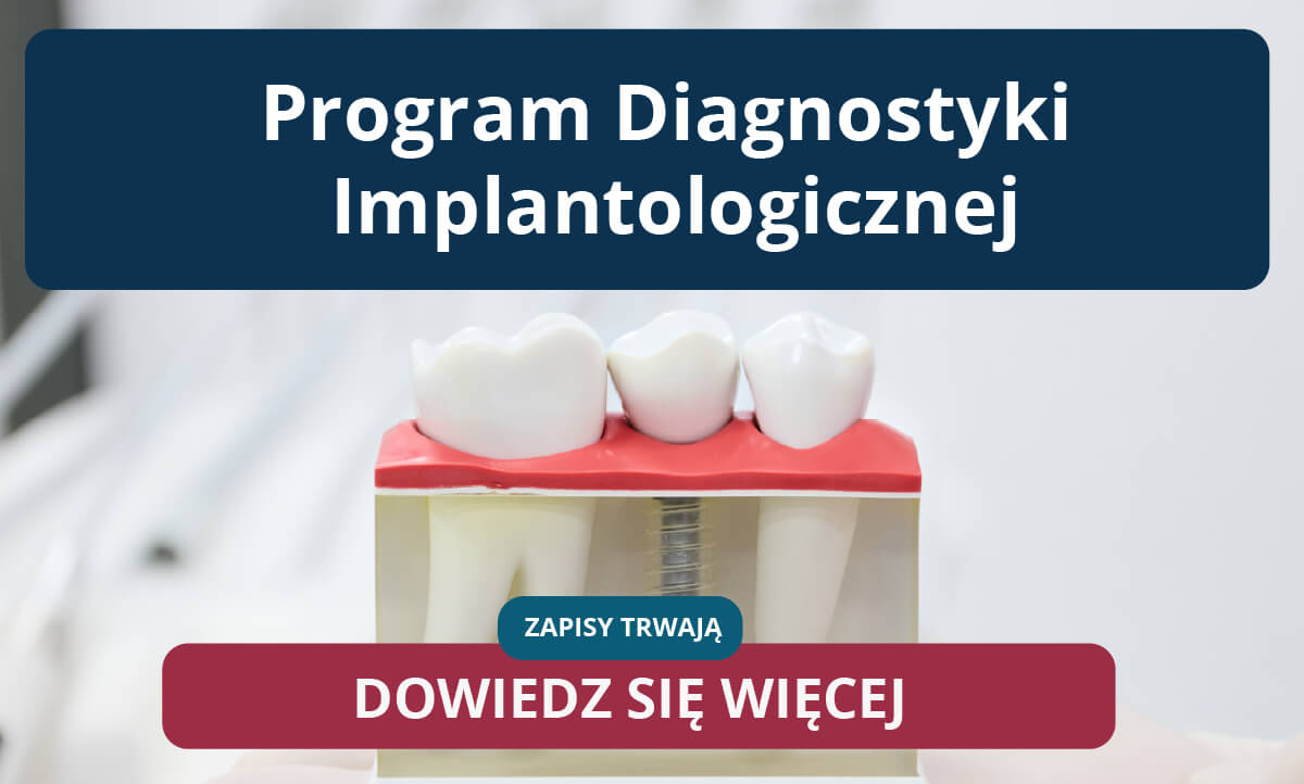 Program Diagnostyki Implantologicznej